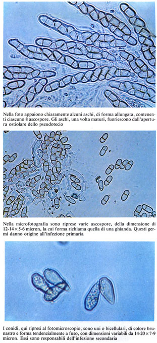Ticchio3